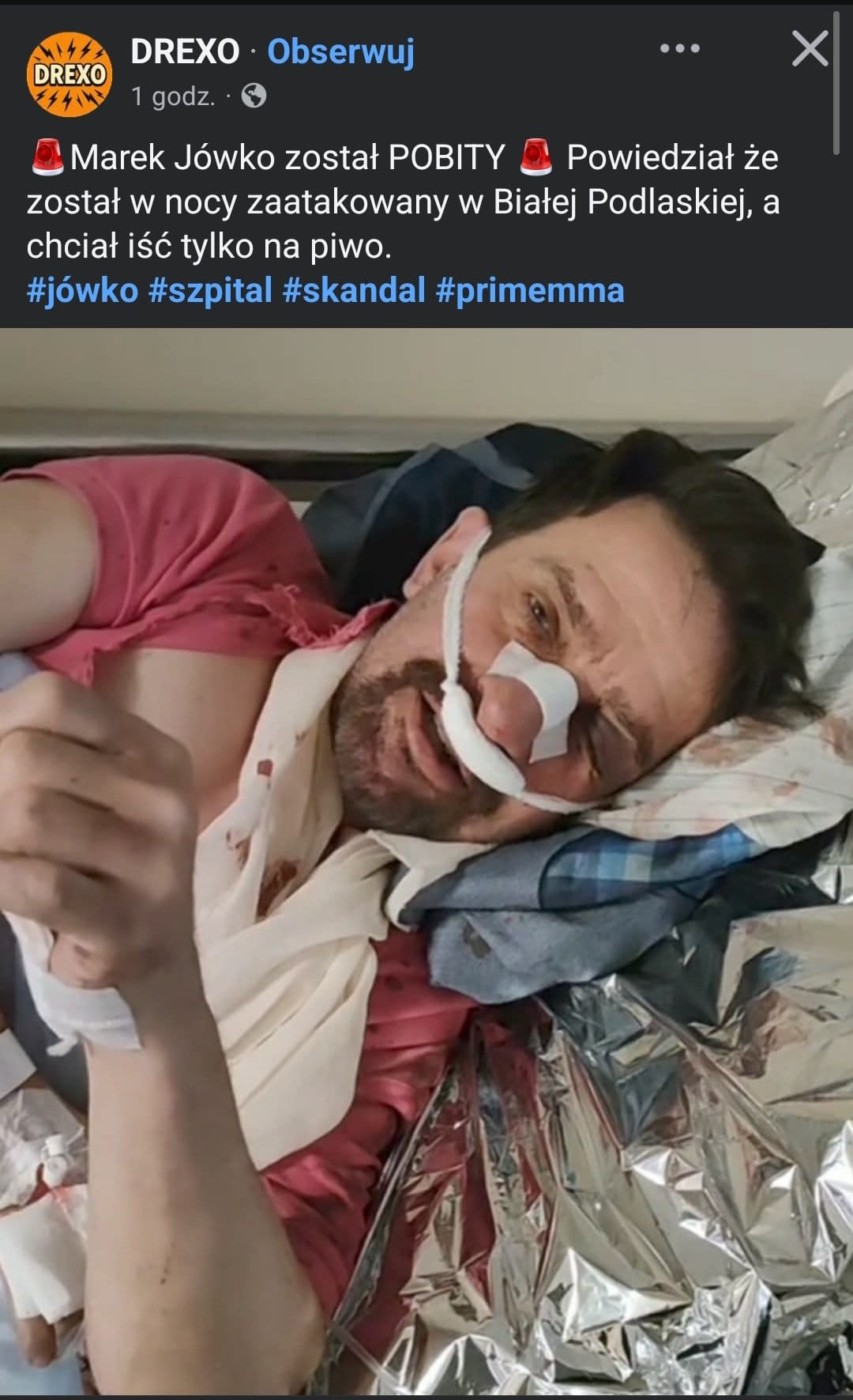Marek Jówko pobity
pobicie Marka Jówki
Marek Jówko szpital
Marek Jówko Biała Podlaska