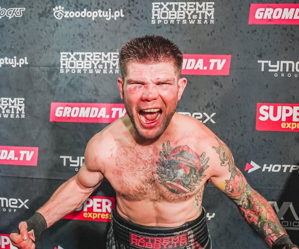 Don Diego po wypadku
freak fighter miał wypadek
zawodnik walk na gołe pięści miał wypadek