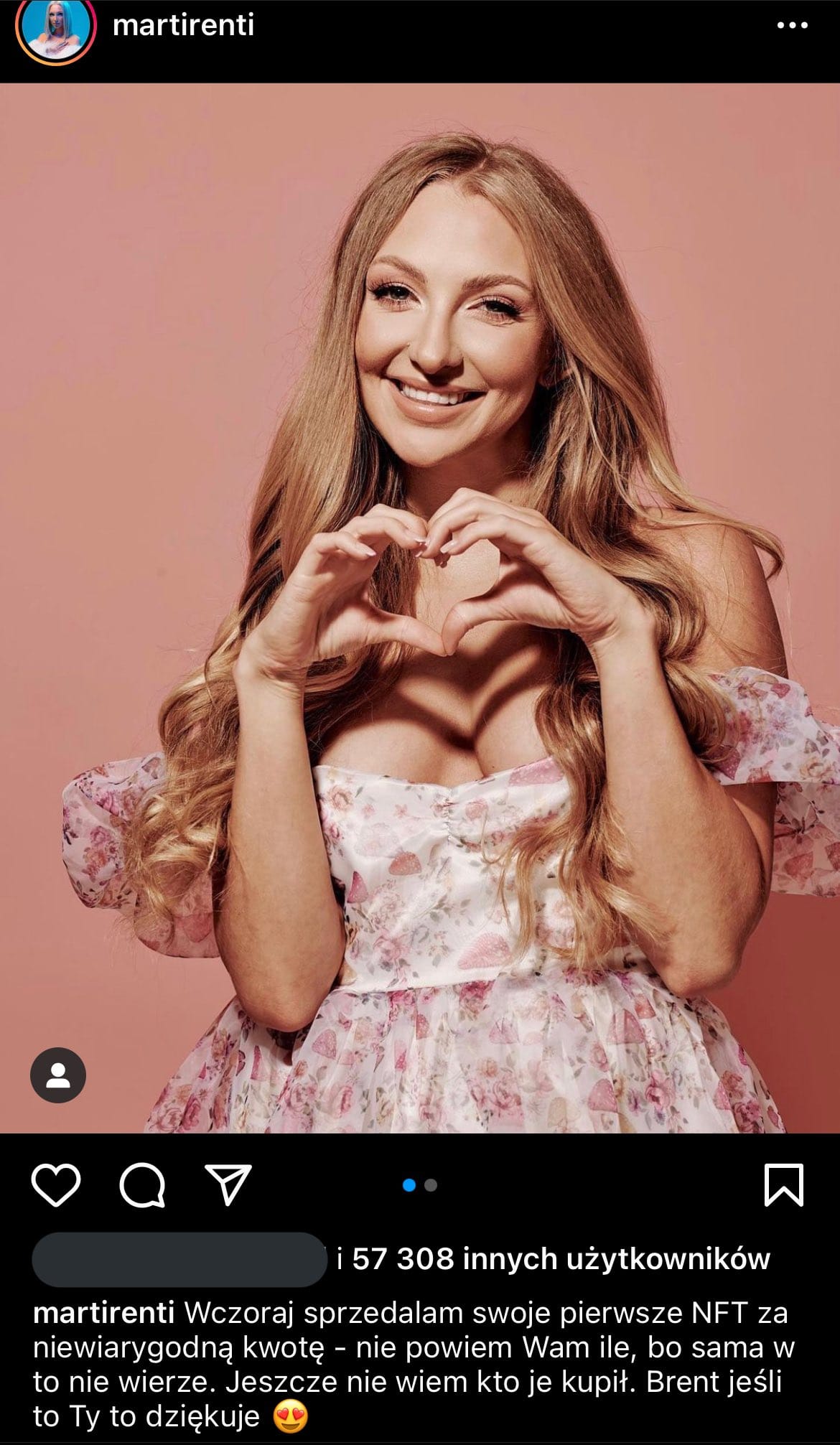 Marti Renti zoperowała nos. Influencerka pokazała nagranie po zabiegu 2 Marti Renti
Marti Renti operacja nosa
Marti Renti nos
Marti Renti zoperowała nos